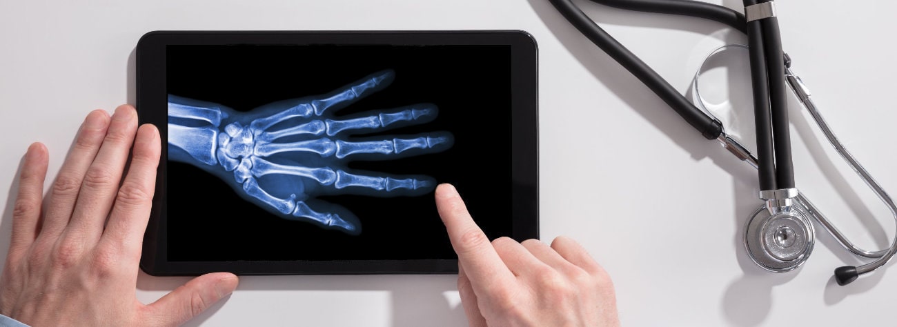 One finger x-ray Lublin