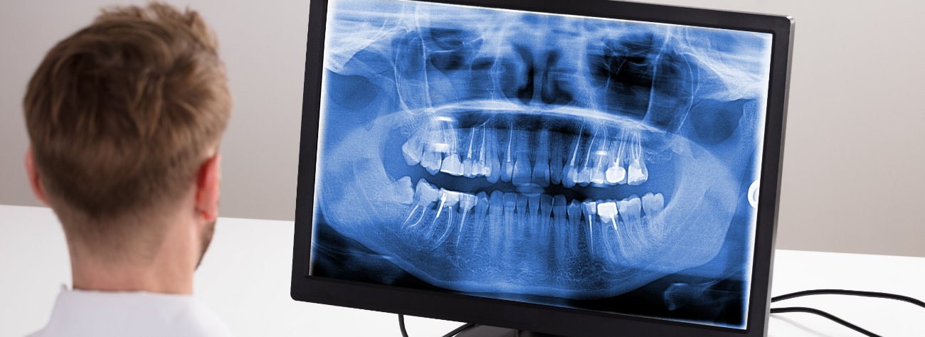 X-ray of one tooth Lublin