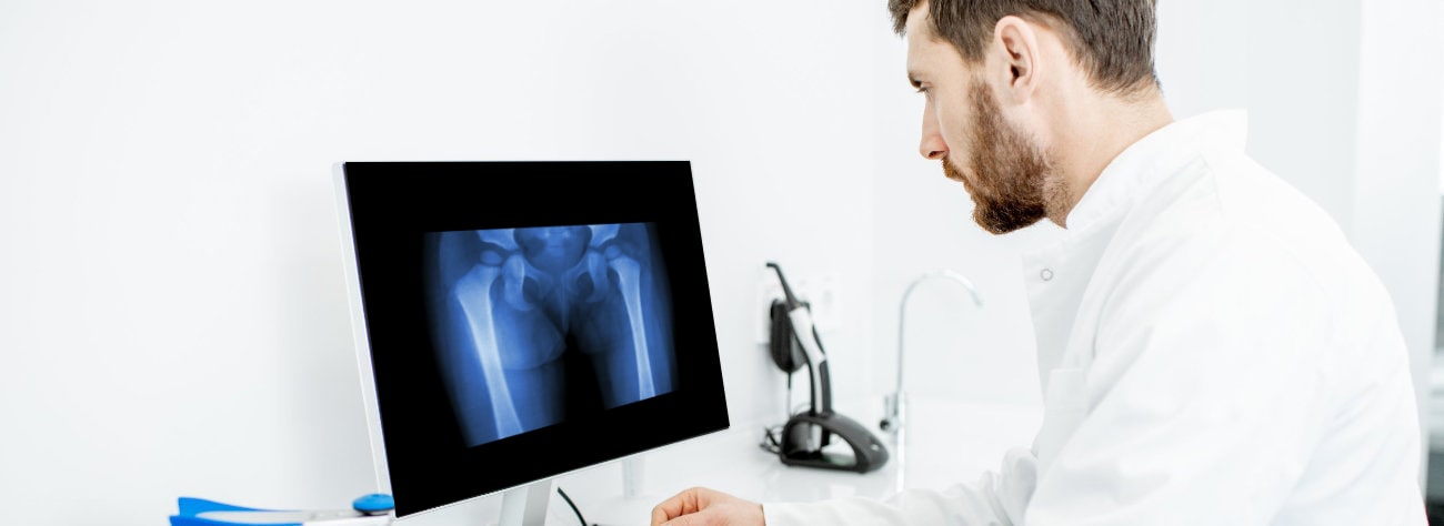 X-ray of shank bone Lublin