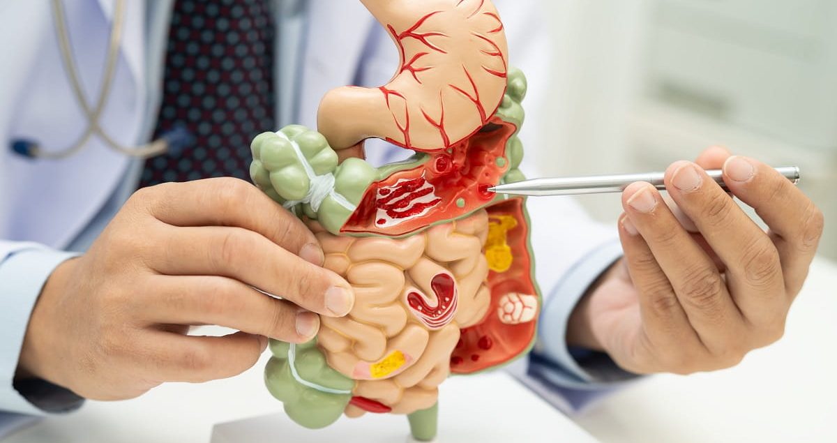 Healthy intestines in summer