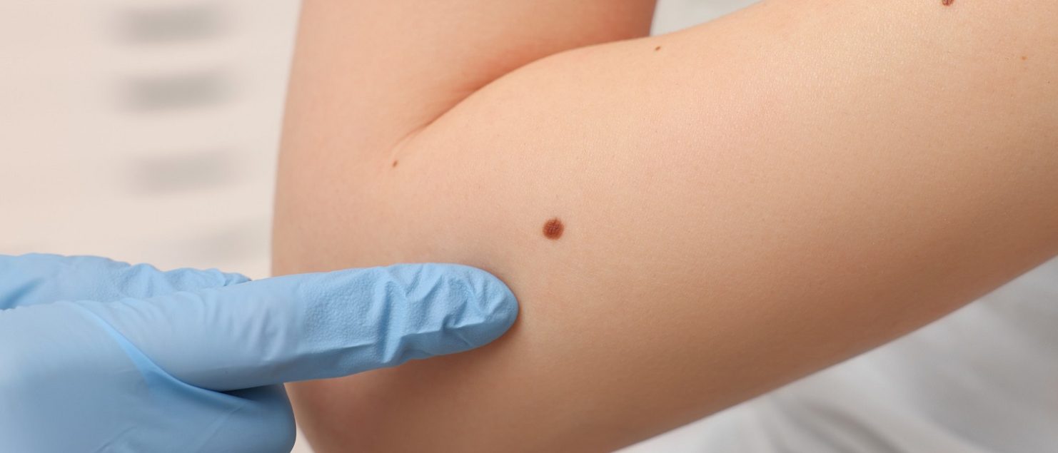 Dermatolog