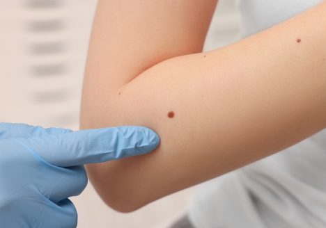 Dermatolog
