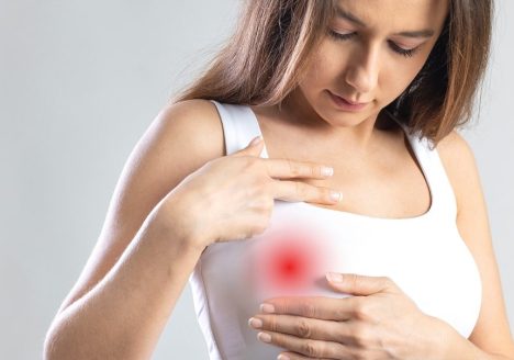 Profilaktyczna mastektomia