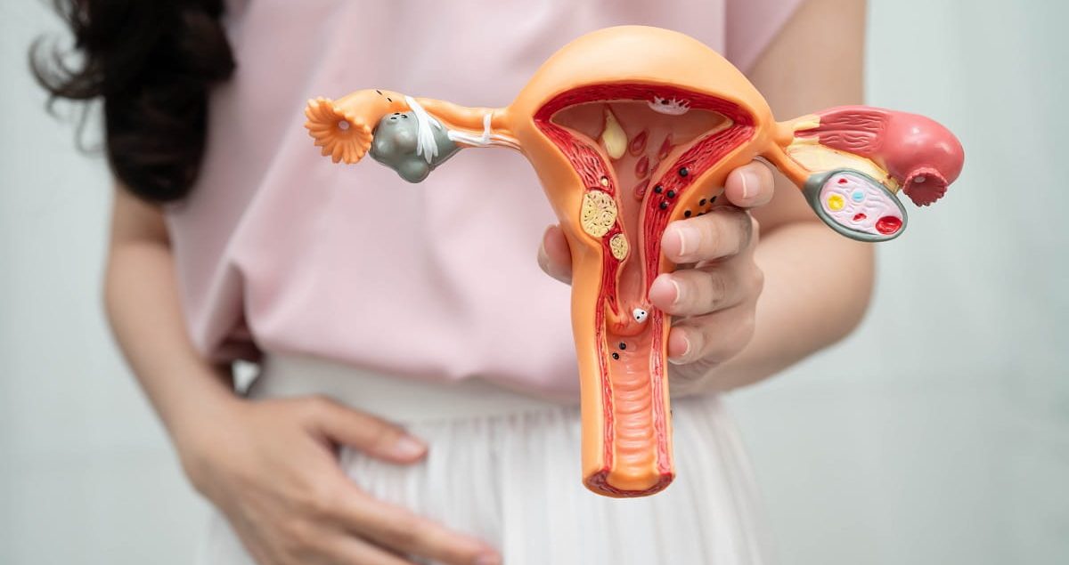 Endometrioza - leczenie w Lublinie